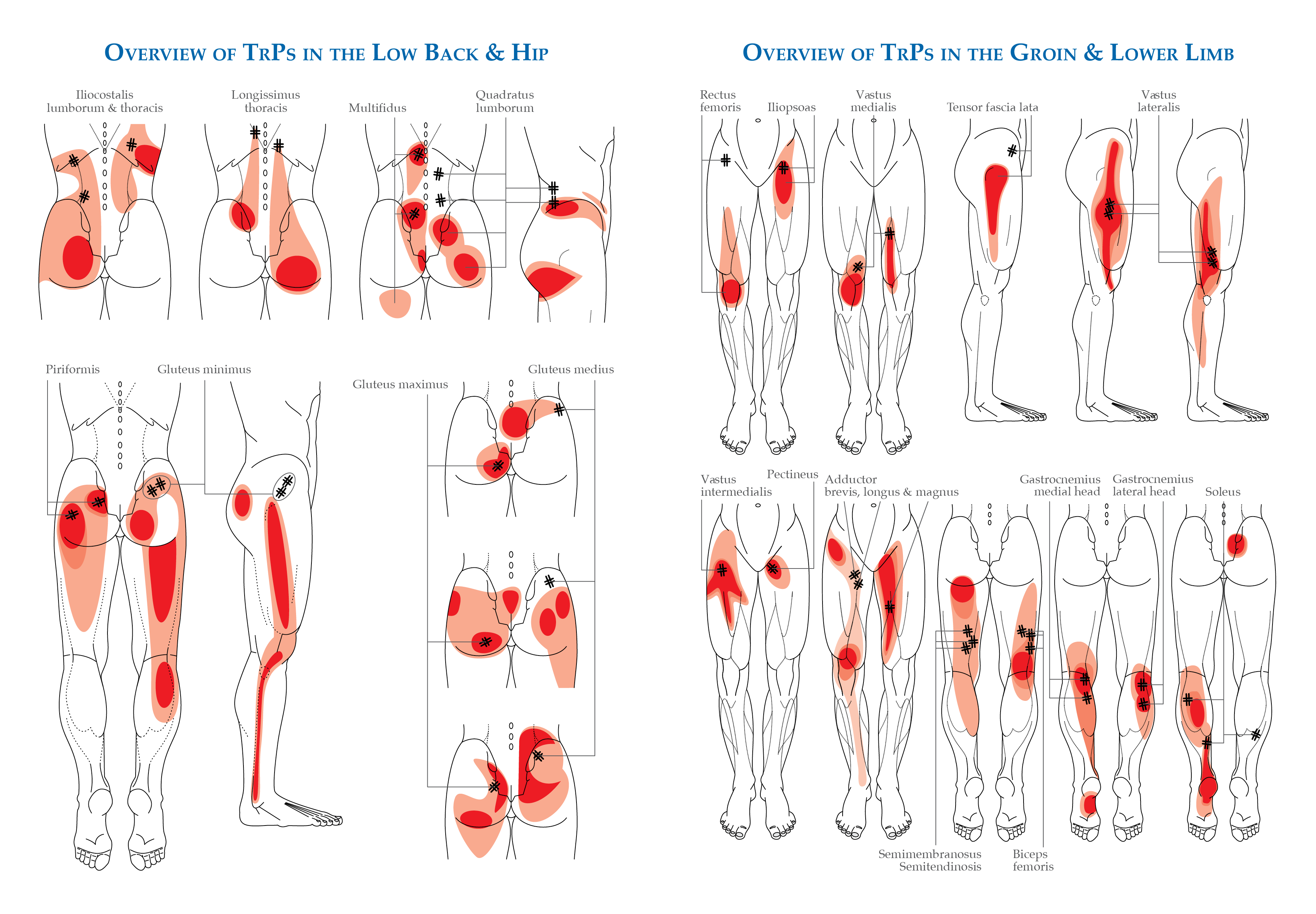 MSK mimics of LS radiculopathy – part 2 – The BMAS Blog