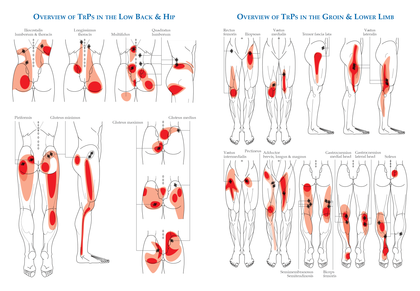 MSK mimics of LS radiculopathy – part 2 – The BMAS Blog